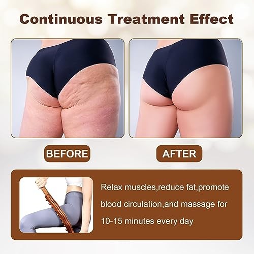 Wood Therapy Guasha Wood Stick Massage Tools, Lymphatic Double Row 20 beads